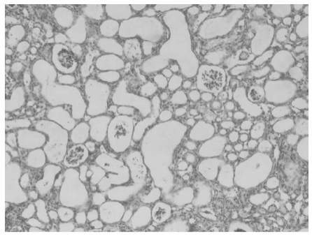 Series Introduction to Active Folate Impurities: ① ການເປີດເຜີຍຜົນກະທົບຂອງອາຊິດ 5-Methyltetrahydropteroic.